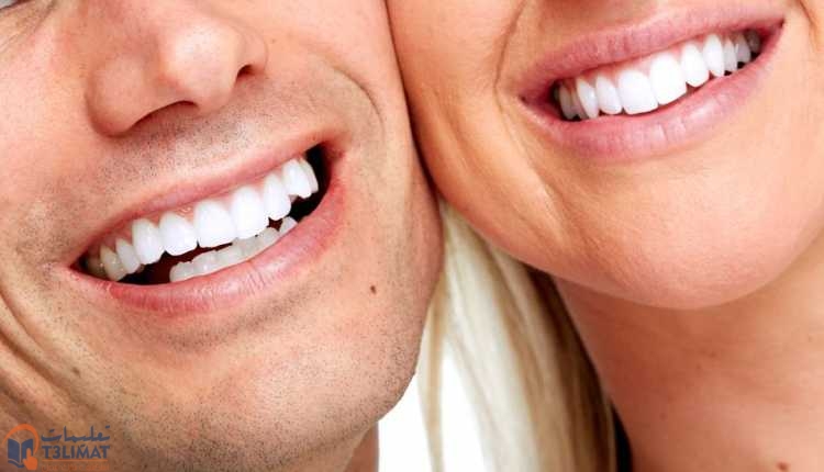 اصفرار الأسنان تبييض الأسنان بالوسائل الطبيعية